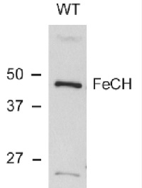 HemH | Protoporphyrin ferrochelatase (cyanobacterial) in the group Antibodies Plant/Algal / Photosynthesis / Chlorophyll at Agrisera AB (Antibodies for research) (AS10 693)